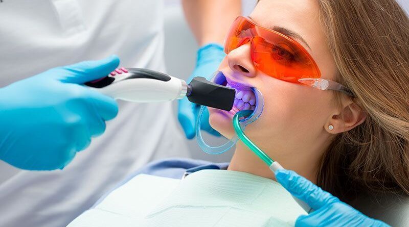 blanqueamiento dental