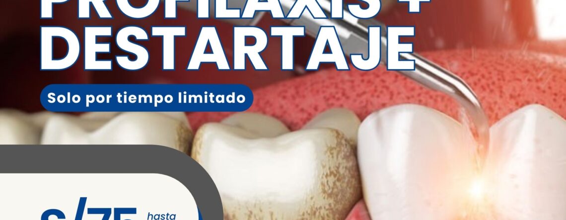 profilaxis denta