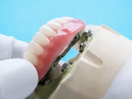 protesis dental removibles