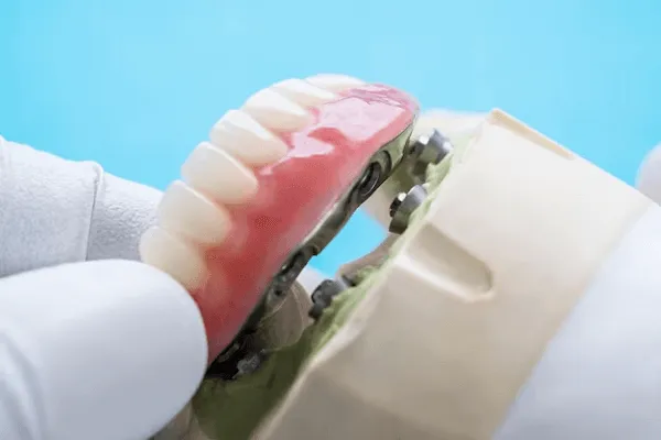 protesis dental removibles